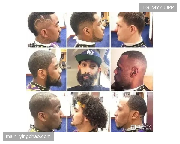 土耳其植发机构瞄准NBA市场计划在美国扩展诊所